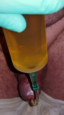 Penis hole with piss catheter cm