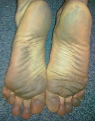 My Dirty Feet