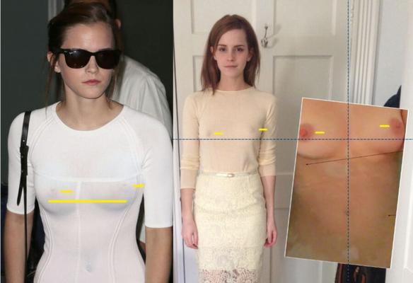 Emma Watson - imagens vazadas