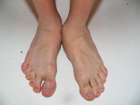 Mes pieds dans les excréments