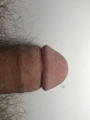 my sad little flaccid small penis